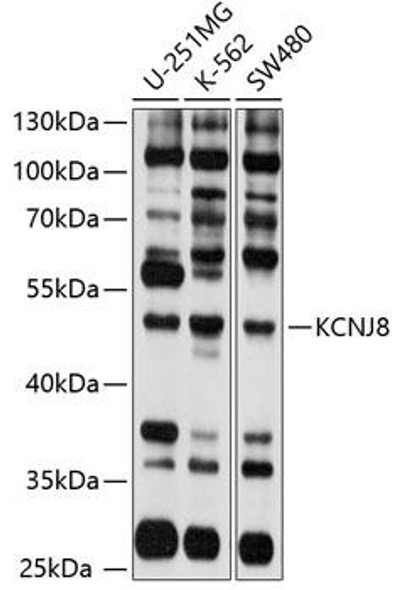 Anti-KCNJ8 Antibody (CAB10563)