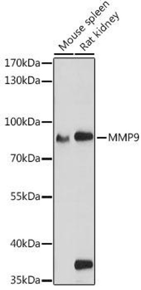 Anti-MMP9 Antibody (CAB11147)