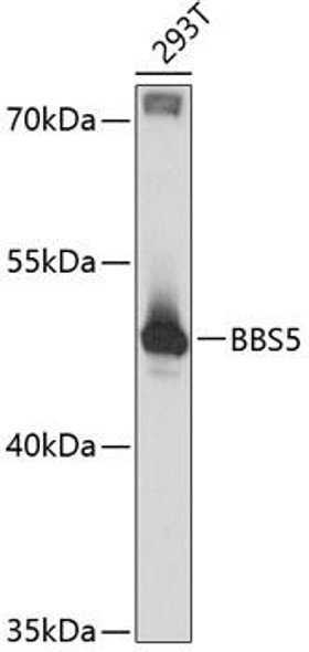 Anti-BBS5 Antibody (CAB12681)