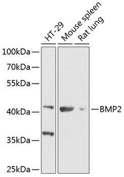 Anti-BMP2 Antibody (CAB12781)