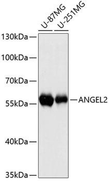 Anti-ANGEL2 Antibody (CAB12799)