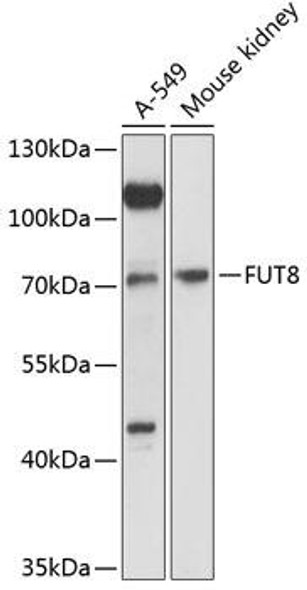 Anti-FUT8 Antibody (CAB12933)