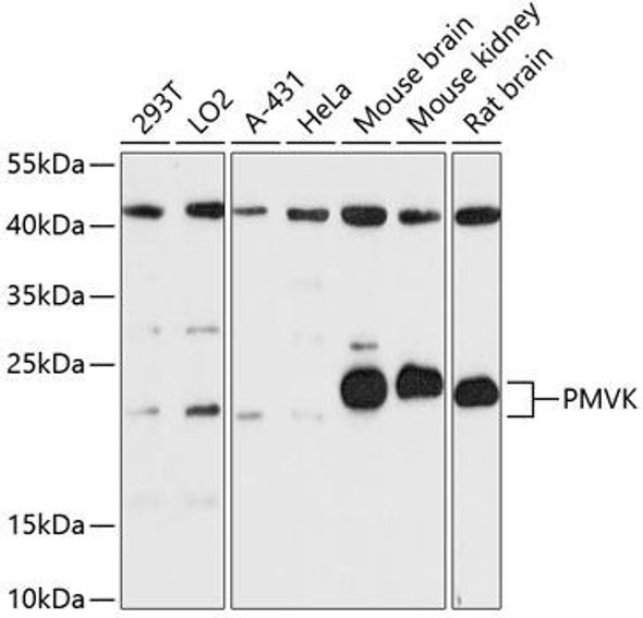 Anti-PMVK Antibody (CAB13865)