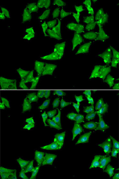 Anti-AGA Antibody (CAB13942)