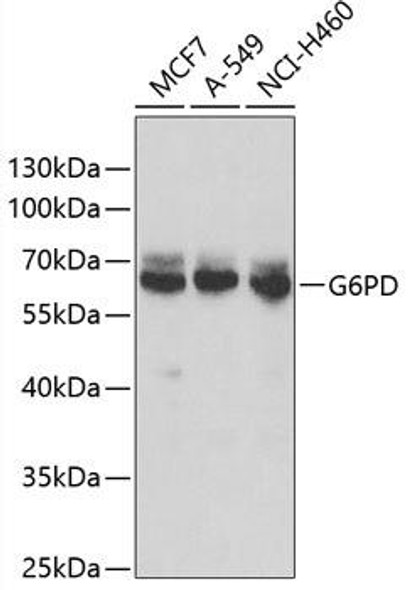 Anti-G6PD Antibody (CAB13983)