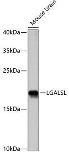 Anti-LGALSL Antibody (CAB14880)