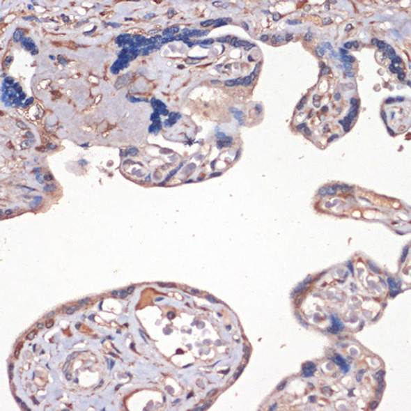 Anti-IGF2 Antibody (CAB2086)