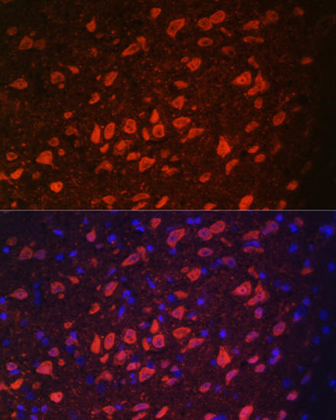 Anti-TRPM2 Antibody (CAB6137)