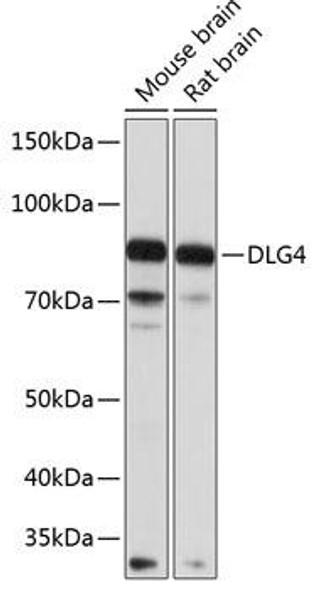 Anti-DLG4 Antibody (CAB6194)