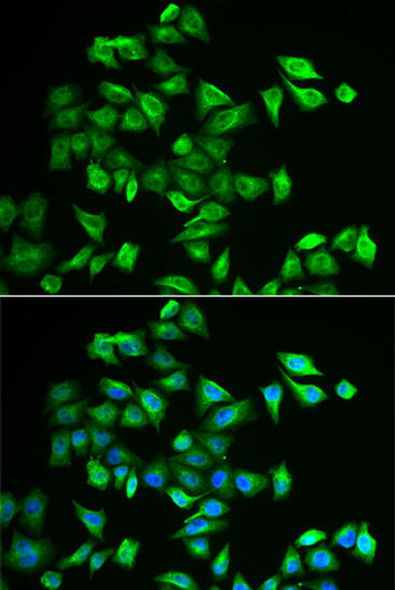 Anti-POMGNT2 Antibody (CAB6484)