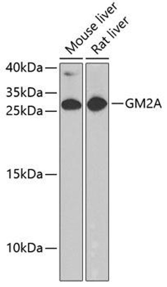 Anti-GM2A Antibody (CAB6605)
