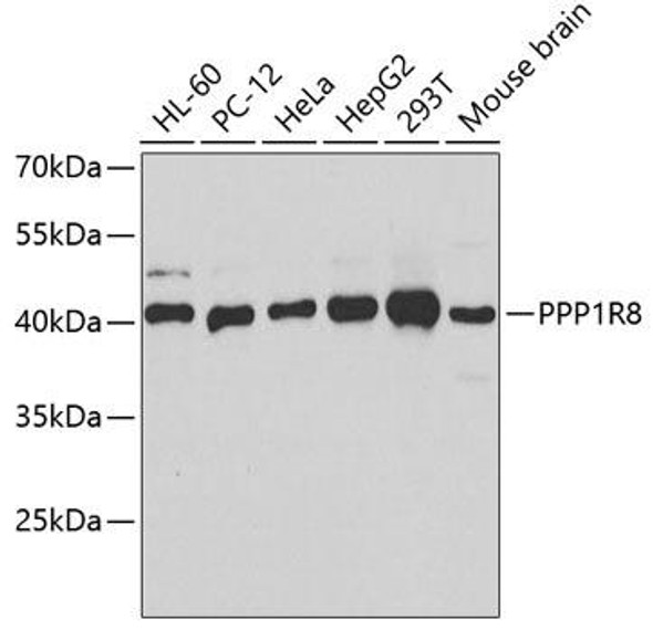 Anti-PPP1R8 Antibody (CAB6701)