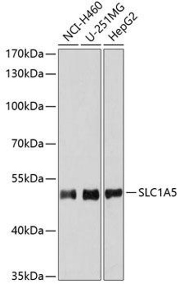 Anti-SLC1A5 Antibody (CAB6981)