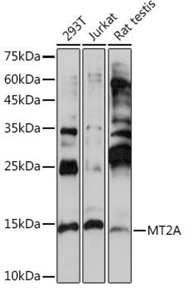 Anti-MT2A Antibody (CAB2018)