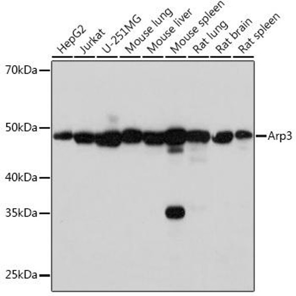 Anti-Arp3 Antibody (CAB4514)