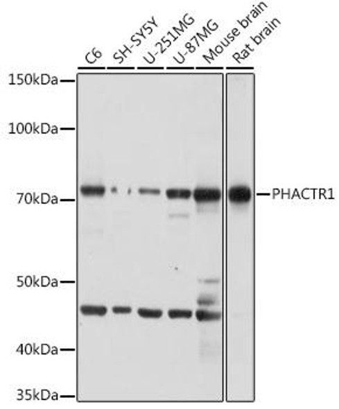 Anti-PHACTR1 Antibody (CAB20154)