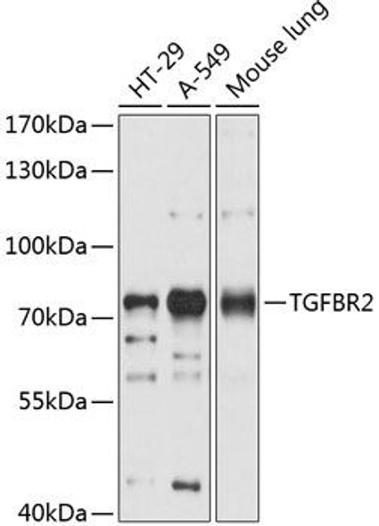 Anti-TGFBR2 Antibody (CAB11765)