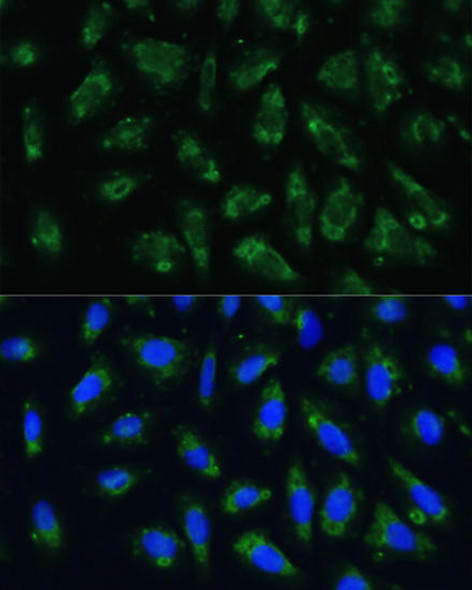 Anti-APOB Antibody (CAB1330)