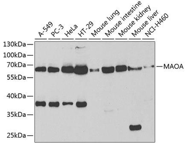Anti-MAOA Antibody (CAB1354)