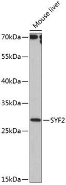 Anti-SYF2 Antibody (CAB14396)