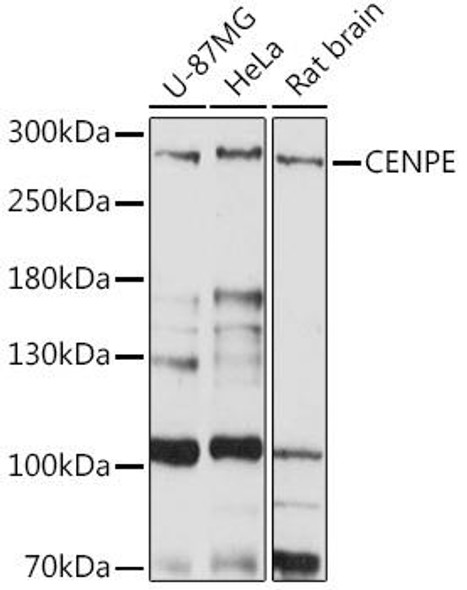 Anti-CENPE Antibody (CAB15263)