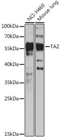 Anti-TAZ Antibody (CAB15806)