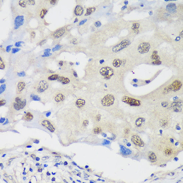 Anti-UCKL1 Antibody (CAB15851)