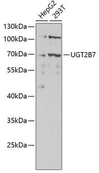 Anti-UGT2B7 Antibody (CAB1693)