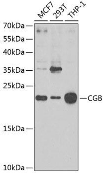 Anti-CGB Antibody (CAB1817)