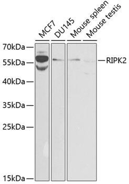 Anti-RIPK2 Antibody (CAB2498)