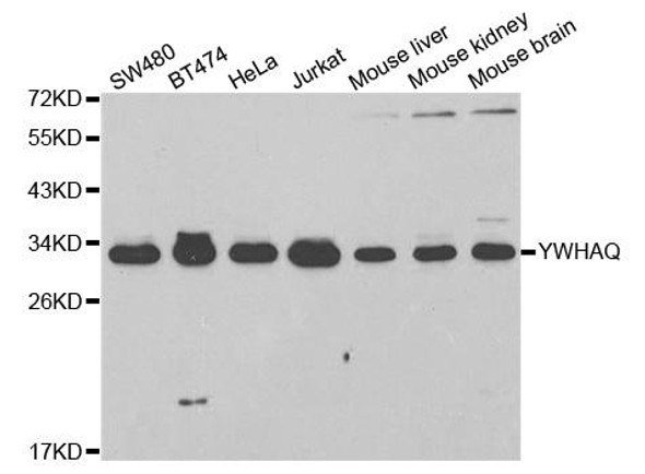 Anti-YWHAQ Antibody (CAB2563)