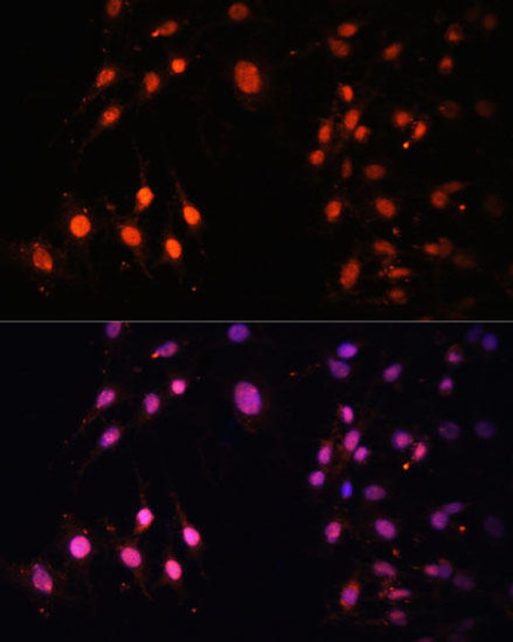 Anti-SETD2 Antibody (CAB3194)