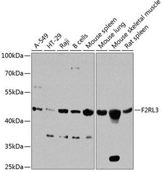 Anti-F2RL3 Antibody (CAB8471)