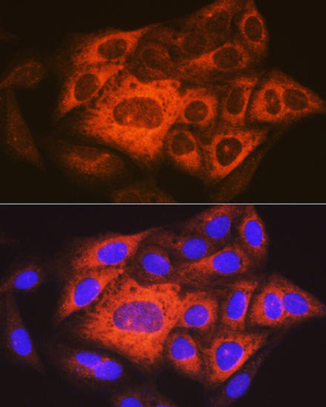 Anti-TACC3 Antibody (CAB18641)