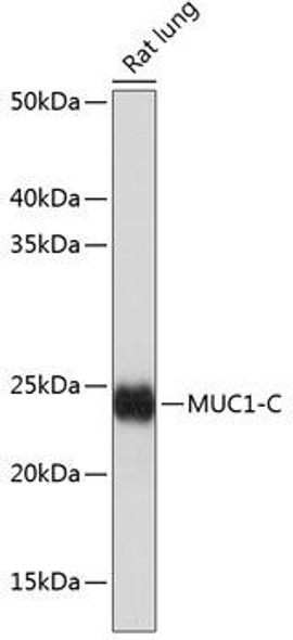 Anti-MUC1 Antibody (CAB19081)