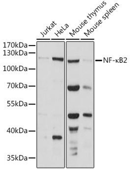 Anti-NF-kB2 Antibody (CAB15694)