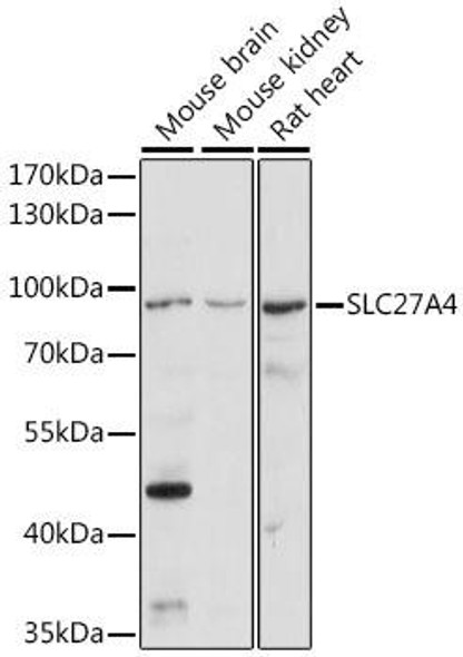 Anti-SLC27A4 Antibody (CAB16101)