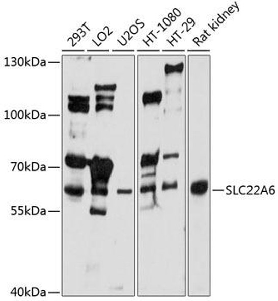 Anti-SLC22A6 Antibody (CAB1814)