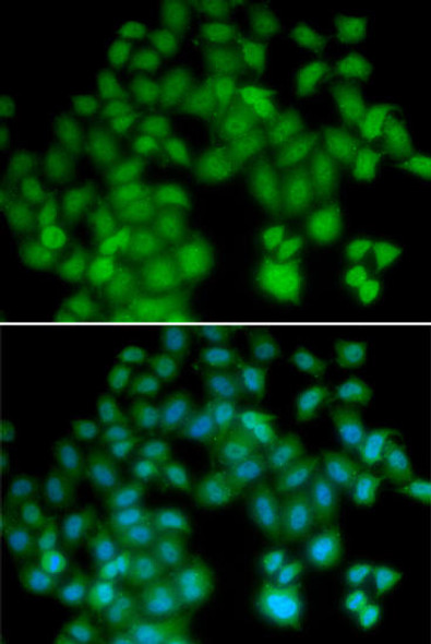 Anti-TMSB4X Antibody (CAB5438)