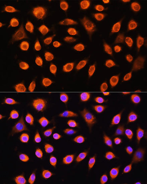 Anti-GNAS Antibody (CAB5546)