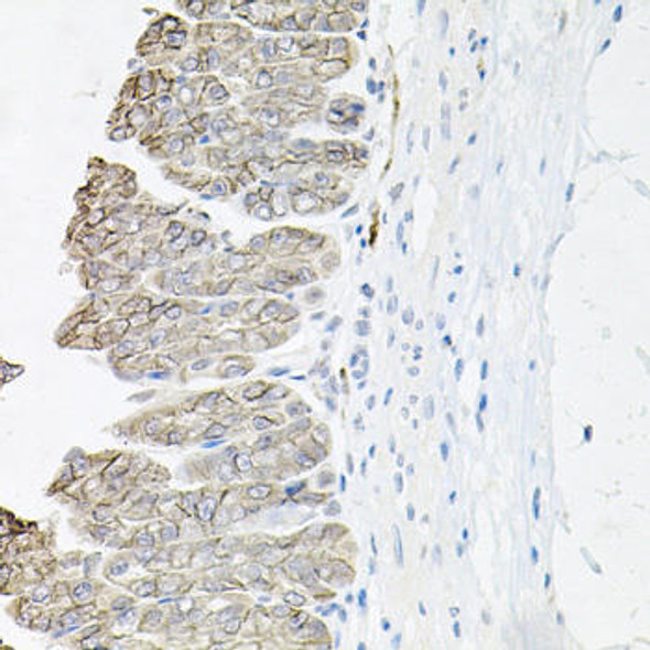 Anti-ATP1B1 Antibody (CAB5793)