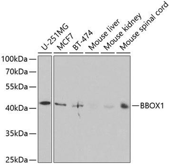 Anti-BBOX1 Antibody (CAB5810)