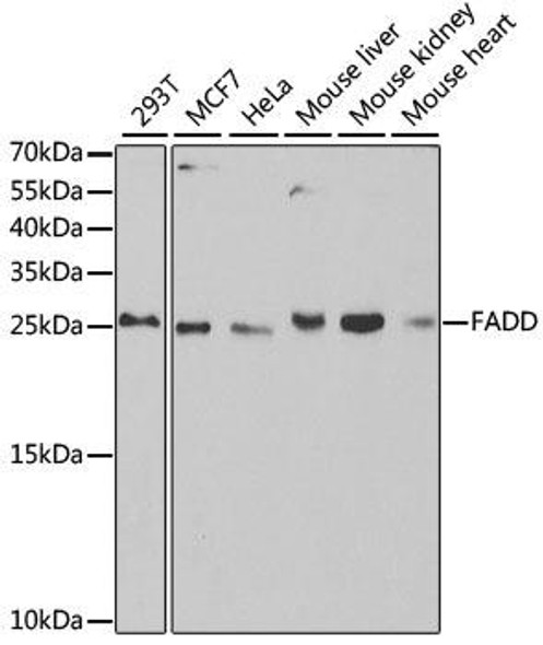 Anti-FADD Antibody (CAB5819)