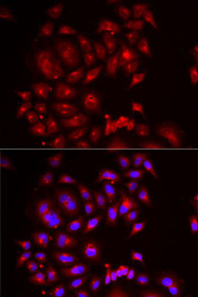 Anti-SLC26A2 Antibody (CAB6369)