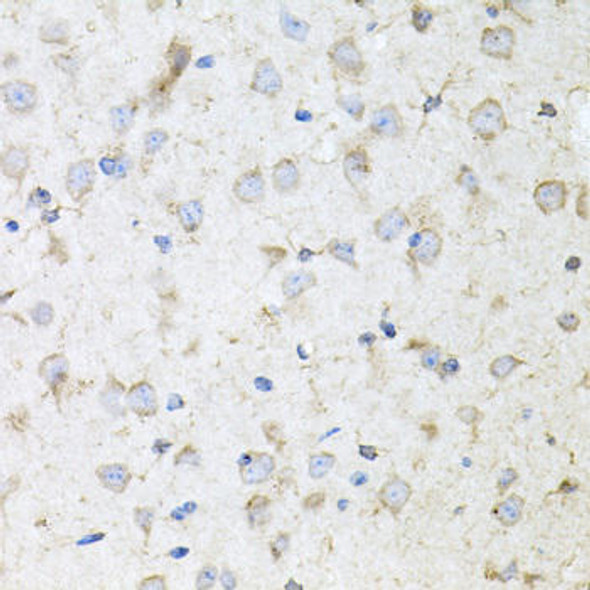 Anti-KLK11 Antibody (CAB6641)