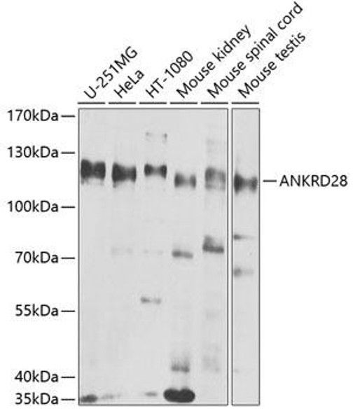 Anti-ANKRD28 Antibody (CAB8365)