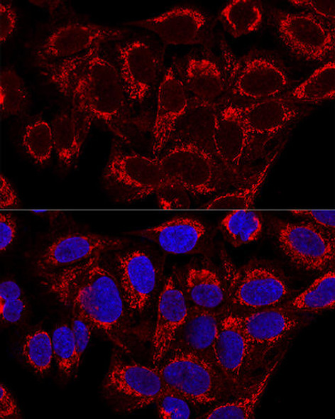 Anti-MRPS16 Antibody (CAB9874)