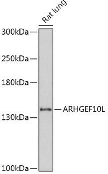 Anti-ARHGEF10L Antibody (CAB17716)