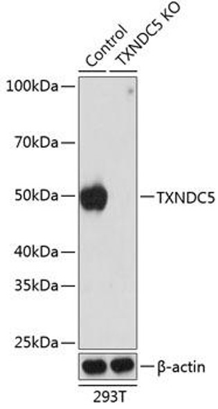 Anti-TXNDC5 Antibody (CAB19930)[KO Validated]
