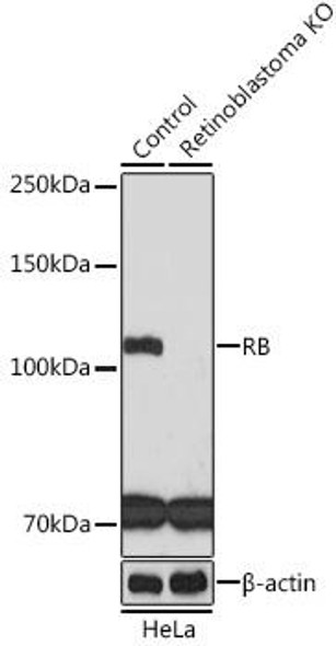 Anti-RB Antibody [KO Validated] (CAB3618)